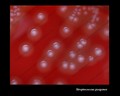 streptococcus pyogenes